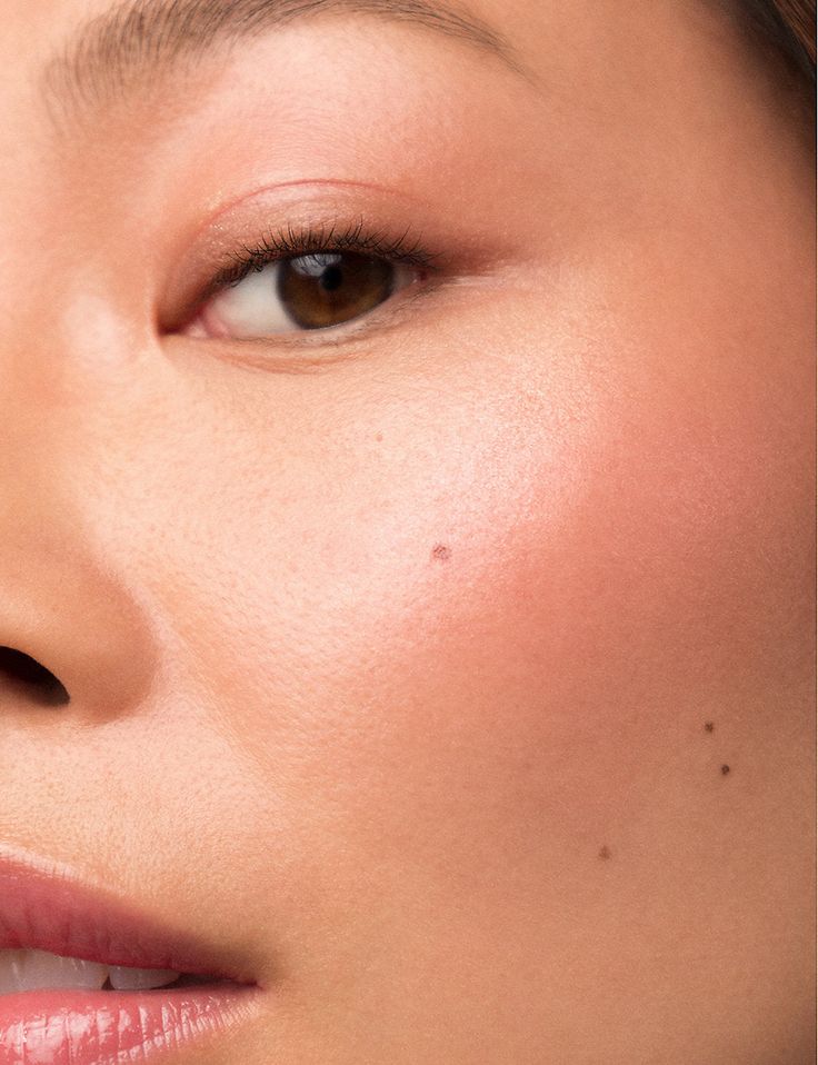 Hifu 12D Facial Tercio medio