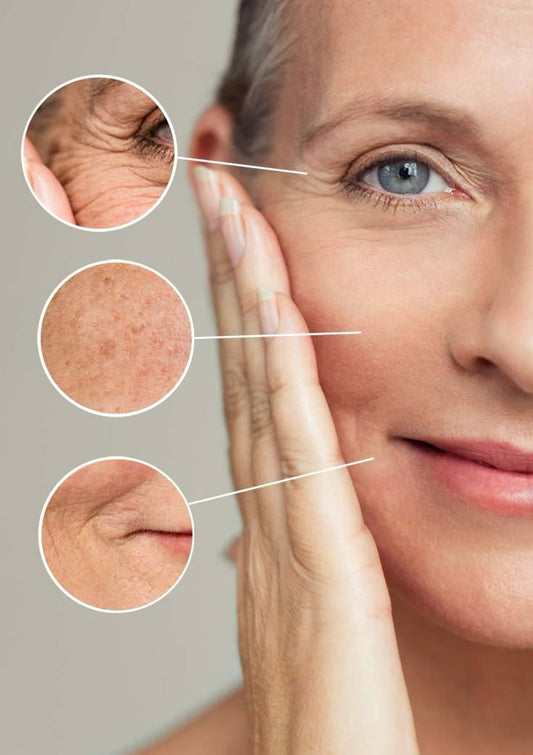 3 Sesiones de Exosomas