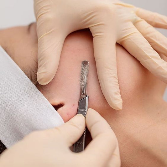 Dermaplaning + higienización facial