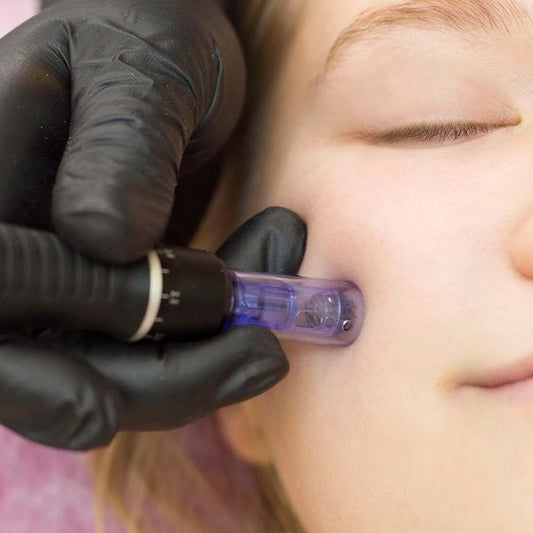 Limpieza Facial Avanzada + Dermapen